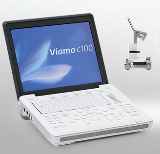 超音波診断装置